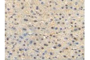 IHC-P analysis of Human Liver Tissue, with DAB staining. (HSP70 1A Antikörper  (AA 1-641))