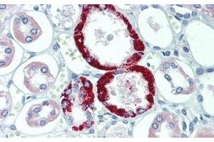Detection of TRPC6 in Human Kidney Tissue using Polyclonal Antibody to Transient Receptor Potential Cation Channel Subfamily C, Member 6 (TRPC6)