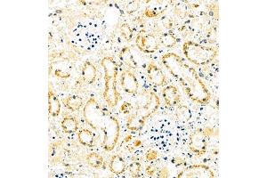 Immunohistochemistry of paraffin embedded mouse ischemic kidney using MUC20 (ABIN7074692) at dilution of 1:1000 (400x lens) (MUC20 Antikörper)