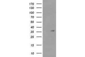 Image no. 1 for anti-Short Chain Dehydrogenase/reductase Family 9C, Member 7 (SDR9C7) antibody (ABIN1500848) (SDR9C7 Antikörper)