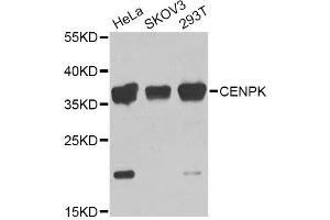 Western blot analysis of extracts of various cell lines, using CENPK Antibody (ABIN5975309) at 1/1000 dilution. (CENPK Antikörper)