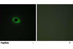 Immunofluorescence analysis of COS-7 cells, using TNS3 polyclonal antibody . (TNS3 Antikörper)