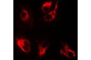 Immunofluorescent analysis of BMPR1B staining in MCF7 cells.
