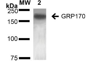 Western Blot analysis of Rat Liver showing detection of ~170 kDa GRP170 protein using Mouse Anti-GRP170 Monoclonal Antibody, Clone 6E3-2C3 (ABIN2868640). (HYOU1 Antikörper  (FITC))