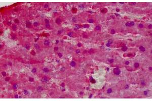 Human Liver: Formalin-Fixed, Paraffin-Embedded (FFPE) (Glutathione Peroxidase 1 Antikörper  (AA 127-193))