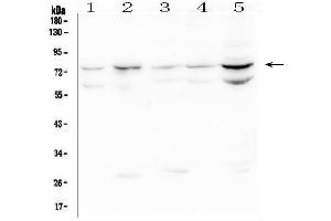Western blot analysis of OLMF4 using anti-OLMF4 antibody (ABIN6719350).