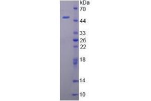 SDS-PAGE analysis of Mouse CAMP Protein. (Cathelicidin Antimicrobial Peptide (CAMP) Peptid)