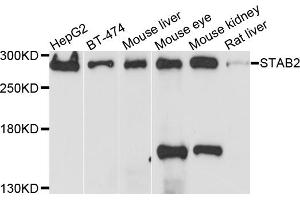 Western blot analysis of extracts of various cell lines, using STAB2 antibody. (Stabilin 2 (STAB2) Antikörper)