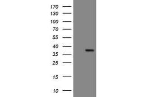 Image no. 1 for anti-Snail Family Zinc Finger 2 (SNAI2) antibody (ABIN1500987) (SLUG Antikörper)