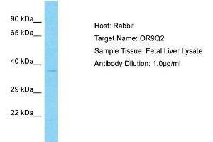 Host: Rabbit Target Name: OR9Q2 Sample Type: Fetal Liver lysates Antibody Dilution: 1.
