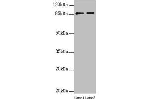 Western blot All lanes: SUPT20H antibody at 0. (SUPT2H (AA 580-779) Antikörper)