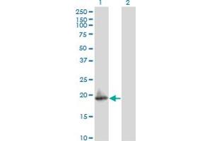 Western Blot analysis of ARF5 expression in transfected 293T cell line by ARF5 monoclonal antibody (M02), clone 1B6. (ARF5 Antikörper  (AA 81-180))