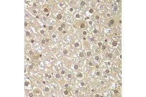 Immunohistochemistry of paraffin-embedded mouse liver using MAD1L1 antibody (ABIN5970500) at dilution of 1/100 (40x lens). (MAD1L1 Antikörper)
