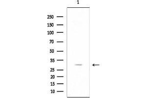 anti-Ribosomal Protein L7-Like 1 (RPL7L1) (Internal Region) antibody