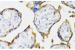 Immunohistochemistry of paraffin-embedded Human placenta using NT5E / CD73 Polyclonal Antibody at dilution of 1:200 (40x lens). (CD73 Antikörper)