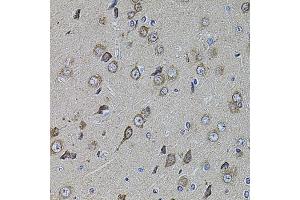 Immunohistochemistry of paraffin-embedded rat brain using UQCRC1 antibody (ABIN5971722) at dilution of 1/100 (40x lens). (UQCRC1 Antikörper)