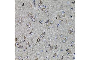 Immunohistochemistry of paraffin-embedded rat brain using UQCRC1 antibody (ABIN5971722) at dilution of 1/100 (40x lens).