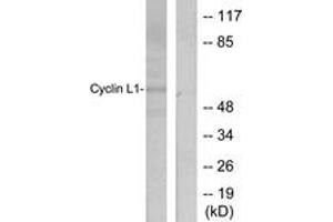 Western blot analysis of extracts from HepG2 cells, using Cyclin L1 Antibody. (Cyclin L1 Antikörper  (AA 461-510))