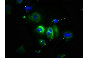 Immunofluorescence (IF) image for anti-Cadherin 1, Type 1, E-Cadherin (Epithelial) (CDH1) (AA 153-641) antibody (ABIN7146190)