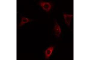 ABIN6275411 staining HepG2 cells by IF/ICC. (PPP1R3C Antikörper  (N-Term))