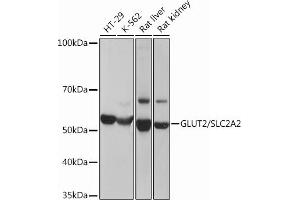 Western blot analysis of extracts of various cell lines, using GLUT2/SLC2 Rabbit mAb (ABIN7270414) at 1:3000 dilution. (SLC2A2 Antikörper)