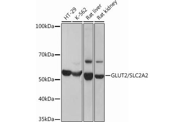 SLC2A2 Antikörper