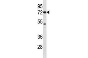 Pak4 antibody western blot analysis in mouse Neuro-2a lysate (PAK4 Antikörper  (AA 187-216))