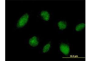 Immunofluorescence of purified MaxPab antibody to TRIM45 on HeLa cell. (TRIM45 Antikörper  (AA 1-562))