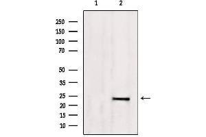 Western blot analysis of extracts from 293, using SM22 aphla Antibody. (Transgelin Antikörper  (C-Term))