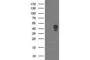 Western Blotting (WB) image for anti-Nudix (Nucleoside Diphosphate Linked Moiety X)-Type Motif 9 (NUDT9) antibody (ABIN1499876)