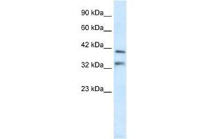 Human Liver; WB Suggested Anti-GSH2 Antibody Titration: 0. (GSX2 Antikörper  (N-Term))