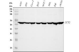 Western blot analysis of CCT2 using anti-CCT2 antibody (ABIN4886512). (CCT2 Antikörper  (AA 414-535))
