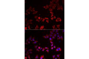 Immunofluorescence analysis of A549 cells using LIMS1 antibody.