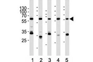 Western blot analysis of lysate from (1) HeLa, (2) rat PC-12, (3) Ramos, (4) mouse NIH3T3 cell line, (5) mouse brain tissue lysate using Pyruvate Kinase/ PKM2 antibody at 1:1000. (PKM2 Antikörper  (AA 476-505))