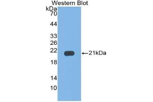 Western blot analysis of the recombinant protein. (IL17C Antikörper  (AA 7-159))
