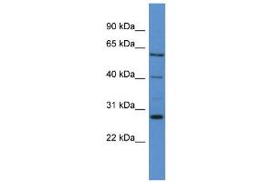 Western Blotting (WB) image for anti-Cytochrome P450, Family 24, Subfamily A, Polypeptide 1 (CYP24A1) (C-Term) antibody (ABIN2788353)