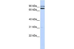 WB Suggested Anti-TRIM67 Antibody Titration:  0. (TRIM67 Antikörper  (C-Term))