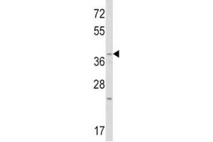 Western Blotting (WB) image for anti-Wingless-Type MMTV Integration Site Family, Member 1 (WNT1) (AA 260-288) antibody (ABIN3029624)