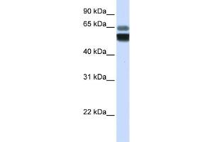 WB Suggested Anti-SMPD1 Antibody Titration:  0. (SMPD1 Antikörper  (Middle Region))
