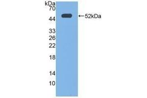 Detection of Recombinant EP3, Human using Polyclonal Antibody to Prostaglandin E Receptor 3 (EP3) (PTGER3 Antikörper  (AA 217-390))