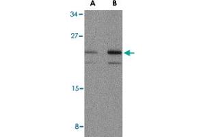 Western blot analysis of IL23A in mouse pancreas tissue lysate with IL23A polyclonal antibody  at (A) 1 and (B) 2 ug/mL . (IL23A Antikörper  (N-Term))