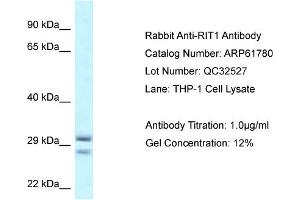 Western Blotting (WB) image for anti-Ras-Like Without CAAX 1 (RIT1) (Middle Region) antibody (ABIN2774323) (RIT1 Antikörper  (Middle Region))