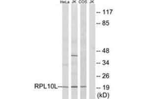 Western blot analysis of extracts from Jurkat/COS7/HeLa cells, using RPL10L Antibody.