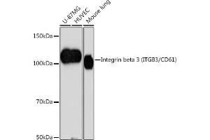 Western blot analysis of extracts of various cell lines, using Integrin beta 3 (ITGB3/CD61) (ITGB3/CD61) antibody (ABIN7267928) at 1:1000 dilution. (Integrin beta 3 Antikörper)