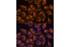 Immunofluorescence analysis of HeLa cells using CAMKV antibody (ABIN7266051) at dilution of 1:100. (CAMKV Antikörper  (AA 1-285))