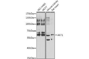 Western blot analysis of extracts of various cell lines, using  antibody (ABIN6133552, ABIN6136735, ABIN6136740 and ABIN6223092). (AKT1 Antikörper  (AA 50-150))