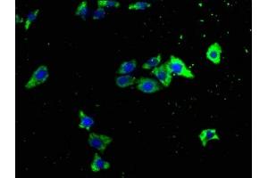 Immunofluorescence staining of HepG2 cells with ABIN7151041 at 1:133, counter-stained with DAPI. (ITCH Antikörper  (AA 29-303))