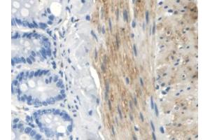IHC-P analysis of Rat Small intestine Tissue, with DAB staining. (TLR5 Antikörper  (AA 325-644))