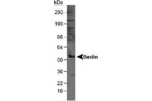 Image no. 3 for anti-Beclin 1, Autophagy Related (BECN1) antibody (ABIN363435) (Beclin 1 Antikörper)