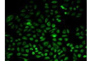 Detection of PSAT1 in Human Hela Cells using Polyclonal Antibody to Phosphoserine Aminotransferase 1 (PSAT1) (PSAT1 Antikörper  (AA 1-312))